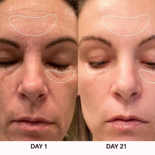 GlowLift Skin Revitalizer Wand